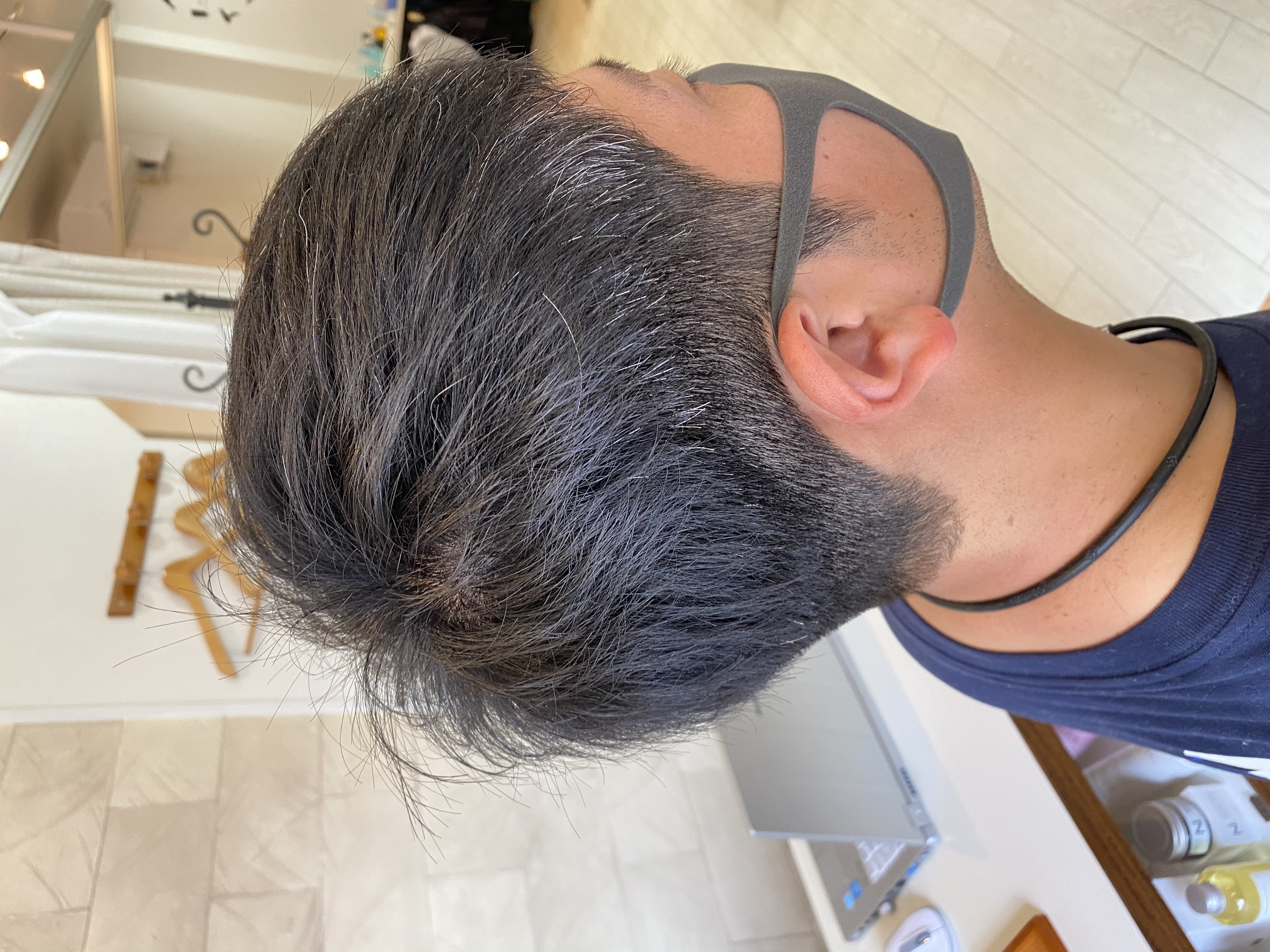 素材美髪®︎ キャルヴォケア
男性専用　薄毛予防　禿げ予防